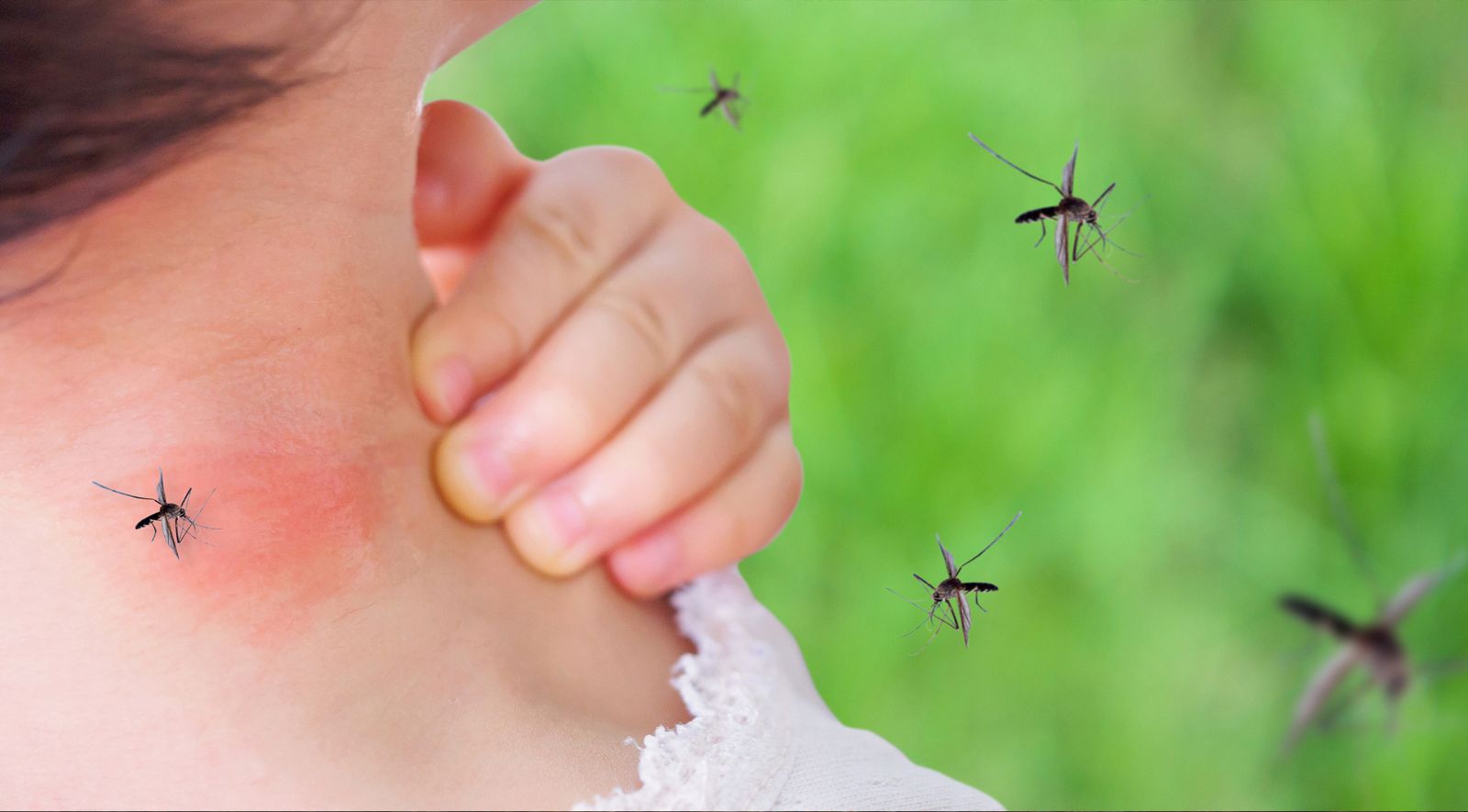 Punture di insetto: proteggetevi in anticipo per evitare un trattamento successivo 