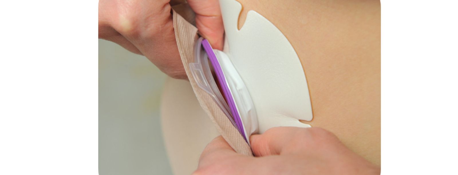 This is Life – Zurück ins Leben mit eakin dot®